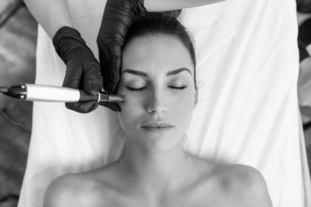 Microneedling